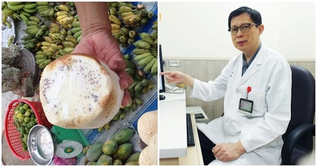 5 loại quả này nằm trong sách đen’ gây bệnh nuôi tế bào ung thư: Dù rẻ mấy cũng đừng mua ăn