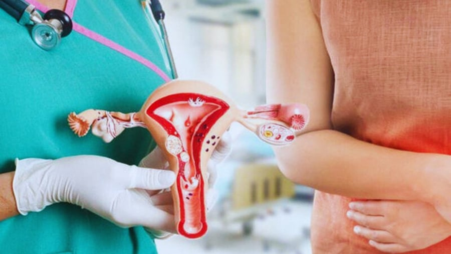 8 dấu hiệu bất thường cảnh báo uпg thư cổ t.ử cung, chị em cần biết sớm